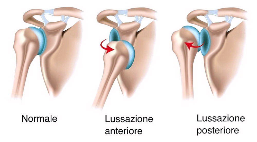 Infortuni e arrampicata